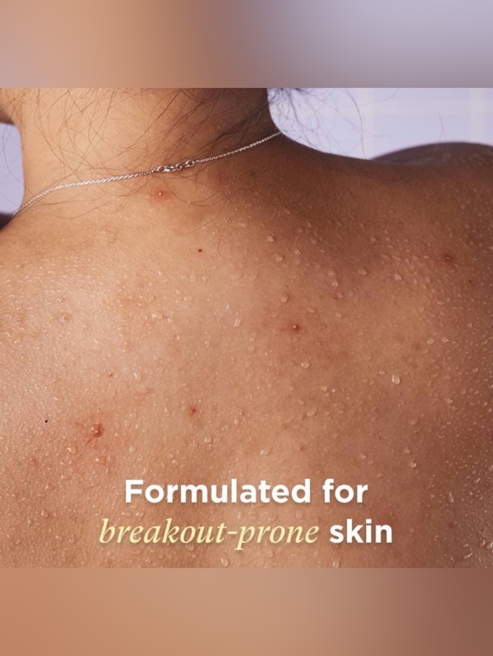 SILKSHAKE by ZitSticka Probiotic-Rich Body Cleanser for Acne-Prone Skin - Picture 5 of 8